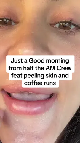 Goodmorning! kids are back to school after a week off!! YAYYYYYYYY now a run to @Dunkin' to start my DAYYYYYYY #morningroutine #coffeerun #kidsoftiktok #morningvibes #fyp #noreason #peelingskin #dunkindonuts 