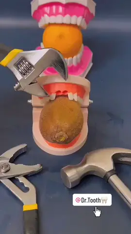 #teeth #repair #tooth #🦷🦷🦷 