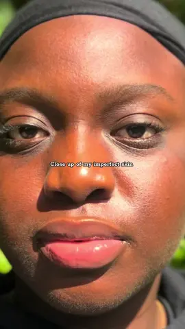 Learning to love the skin im in.  My imperfections make me perect. The journey of finding what works fot my skin and sticking to it gas finally come to a point where i rmbody what it truly means to enjoy the journey. #viral #skincare #skincareroutine #oilyskin #oilypores #influencer #contentcreator #content #selflove #blackgirltiktok #blackgirlluxury #fyp 