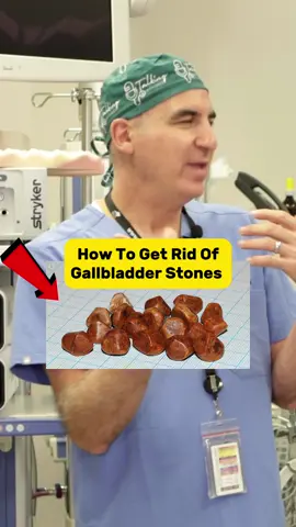 **Detecting Gallstones:** 1. **Painful Episodes:** Persistent pain in the upper right abdomen or between the shoulder blades could be a sign. 2. **Digestive Discomfort:** Bloating, nausea, and vomiting after meals may indicate gallstone issues. 3. **Jaundice:** Yellowing of the skin or eyes might be a result of gallstones affecting the bile duct. **Interventions:** 1. **Dietary Changes:** Adopt a low-fat, high-fiber diet to minimize gallstone formation. 2. **Hydration:** Stay well-hydrated to promote gallbladder health. 3. **Medication:** Some medications may help dissolve smaller gallstones. **Diagnostics:** 1. **Ultrasound:** A non-invasive imaging test to visualize gallstones. 2. **CT Scan:** Provides detailed cross-sectional images for a clearer diagnosis. 3. **Blood Tests:** Evaluate liver function and identify signs of inflammation. **Surgery:** 1. **Laparoscopic Cholecystectomy:** Commonly performed to remove the gallbladder minimally invasively. 2. **Open Surgery:** In complex cases, traditional open surgery may be necessary. Always consult a healthcare professional for accurate diagnosis and guidance tailored to your specific situation.  #gallstones #gallbladder #gallbladdersurgery #surgery #gallbladderremoval #cholecystectomy #health #gallstone #gallstonesdiet #piles #gallbladderstones #cholecystitis #healthylifestyle #gallbladderdiet #cancer #healthyfood #laparoscopicsurgery #weightloss #gallstonesurgery #gallbladderproblems #doctor #herniasurgery #healthyeating #slimmingworld #lowfatdiet #laparoscopy #liver #kidneystones #hiatushernia #guthealth 