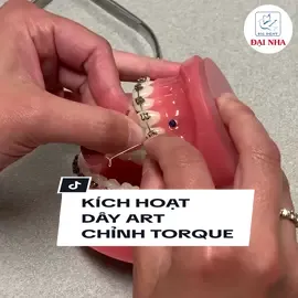 Cách kích hoạt dây ART chỉnh torque 👍 #vatlieuchinhnha #khoahocchinhnha  #ctydainha #chinhnha #LearnOnTikTok 