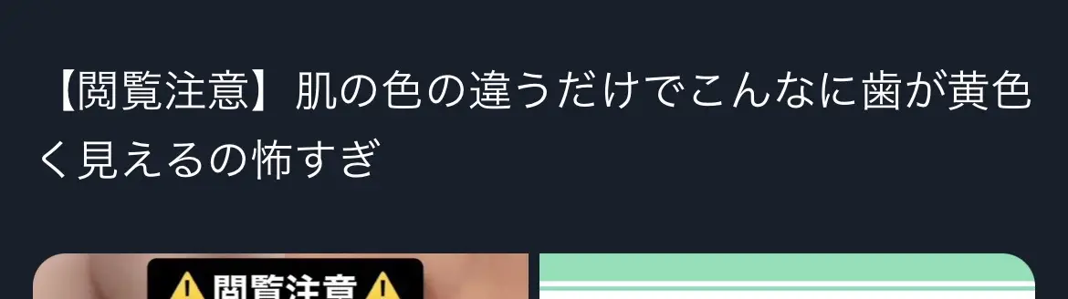 #垢抜け教科書 #可愛くなりたい #歯を白くする方法 #歯を白くしたい #ホワイトニング #歯の黄ばみ #モテる方法 