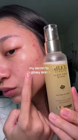 thank me later 💅🏼 jk but i actually am in love with this serum and i have super dry skin i seriously spray it day and night ✨ #glowyskin #dalbaglobal #dalbamist #dalbaglow #dalbapartner #whitetruffle #amazonfinds