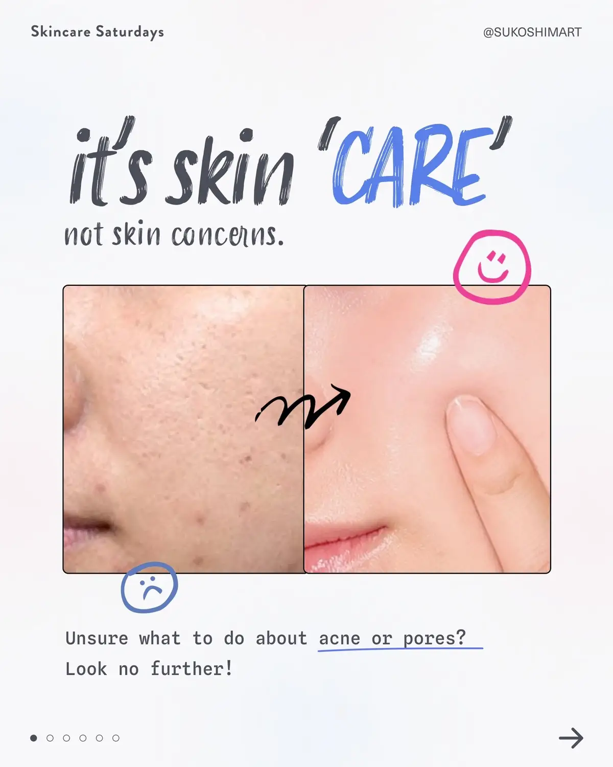 unsure of how to care for your skin concerns? we got you covered 🫡 #skincareroutine #koreanskincareproducts #acneproneskin #largeporesskincare 