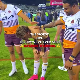 ⚠️GRAPHIC WARNING⚠️ #yowyeh #tuff #heart #injured #injuries #nrl #nrlfyp #coolnrl #fyp 