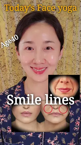 Smile line faceyoga 팔자주름 패인 자리에 입꼬리 근육 운동을하여 근육으로 채워주고 마사지해준다 #faceyoga#sianfaceyoga#페이스요가#시안페이스요가#smileline 