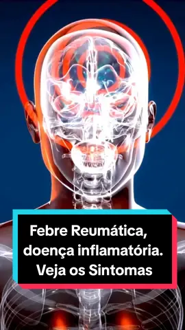 Febre Reumática, doença inflamatória. Veja os Sintomas #febrereumatica #inflamação 