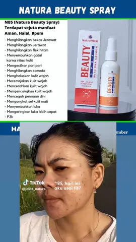 spray terbaik buat ngatasi masalah jerawat dan bruntusan bebs... taiwan ready giih .. order wa.me//886981838349 #naturabeautyspray  #readytospray #fyptaiwantiktok #fypdonggggggg #seluruhtaiwan 