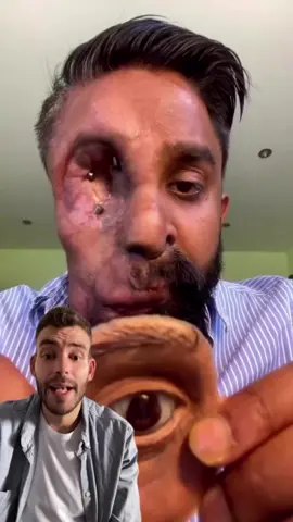 Esto SI ayuda #salud #imagen #invento #ayuda #real 