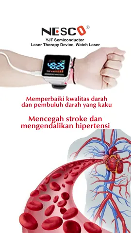 Nesco YJT Semiconductor Laser Theraphy Device.alat terapi mencegah dan atasi stroke,mengendalikan hipertensi, serangan jantung,diabetes dan kolesterol serta memperlancar peredaran darah . Memperbaiki kwalitas darah dan pembuluh darah. #menggunakantehnologilaser#tehnologilaser #mencegahhipertensi #hipertensi #hypertension #mencegahstroke#mencegahgagalginjal #gagalginjal #mencegahdiabetes #diabetes #coldplayfans #coldplay #coldplayjakarta.                                                                           # Link pembelian.                                                   # https://shopee.co.id/Laser-Therapy-Device-WATCH-LASER-alat-untuk-membantu-mempercepat-pemulihan-pasca-stroke-i.119492011.18237220466?sp_atk=4954d7f8-938a-4dcf-8443-37a1ccb1f8ab&xptdk=4954d7f8-938a-4dcf-8443-37a1ccb1f8ab