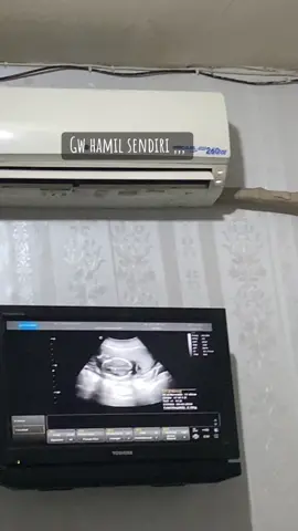 Semangat demi anak 🤲🏻😇🤰🏼👶🏻#pregnant#bumilsehatbayisehat🤰♥️😘😘#pregnanttiktok#fypシ#tm2#tanpadukungantapiharusbisa#tanpasuami 