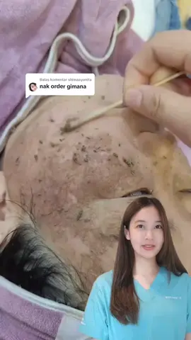 Membalas @shimaayunita #peeloff #top #lighteningpeeloffmask #treatmentpeeling #trending #viral #fyp #gayaditiktok🔥 #flekhitam 