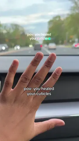 this is so embarassing to post but really proud of myself lol 🤭❤️ for what it’s worth the beginning clip is v old!! haha #cuticlecare #cuticleprep #cuticlepeeling #nailscheck #nailhealth #grwm #blackgirltok #blackgirltiktok #letsgetdressed #OOTD #getreadywithme 