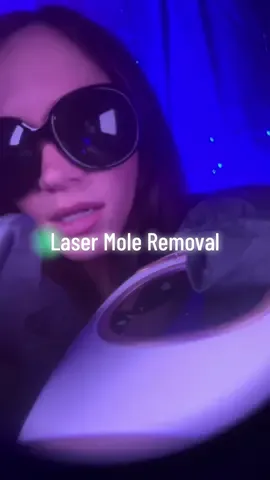 Laser mole removal treatment ⚡️ #asmr #asmrsounds #asmrvideo #asmrskincare #asmrmedical #asmrroleplay #fyp 