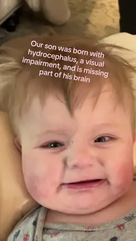 Non traditional things in our family :)  #stayathomedad #stayathomedads #hydrocephalus #hydrocephalusawareness #corticolvisualimpairment #momsunder25 #tattooartist 