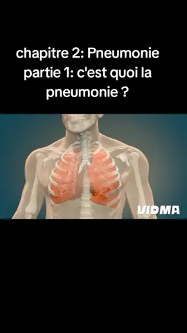 chapitre 2: Pneumonie partie 1: c'est quoi la pneumonie #santé #maladie #africans #monde #pneumonie #traitement 