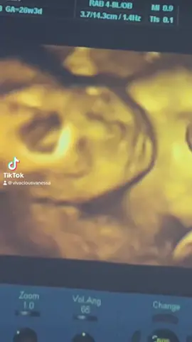 Thank you, Vanessa, for allowing us to be a part of your beautiful journey ♥️ #Baby #Pregnancy #3D #Ultrasound #Love #Family #Happiness 