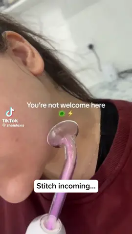 Could you zap your acne away? ⚡️🦠 #high frequency wand on a pimple #highfrequencyfacial #highfrequency #highfrequencywand #acnetreatment #acneproneskin #beautydevice #skincaredevice #acnedevice #argon #neon #antiagingdevice #antiaging 