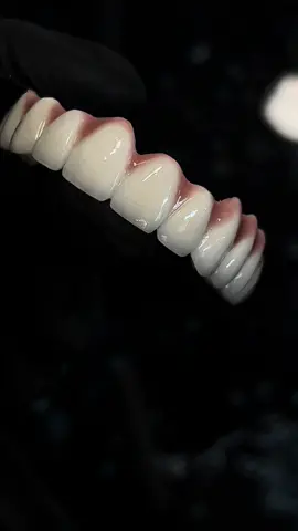 Full mouth implant supported crowns 😊#artdent_dental_laboratory #dentallab #dentallife #dentallabwork #dentalsolutions #dentalcrowns #dentalbridge #dentalimplants #implantsupportedcrowns #implantology #smilecreator #smilecreative #smilemakeover #smiledaychallenge #smilemore #newsmile #newteeth #straightteeth #whiteteeth #teeth #tooth 