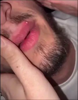 #cravos #brufoli #blackhead #zit #pimples_brufoli_ #popper #pimple #acne #pimples_brufoli #popping #zits #asmr #pimples #pimplepop #granosyespinillas #granos 