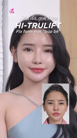 Nếu làm Hifu mà không thấy hiệu quả, hỏi bạn đã làm Đúng Hifu chính hãng chưa ạ #shynhhouse #hifu #lamdep 