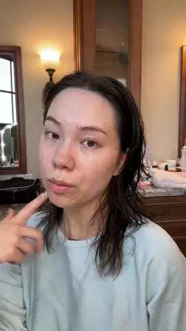 how i cover up my acne <3 #grwm #acnemakeup #acneskin #acnescars #acnetreatment #acnetips 
