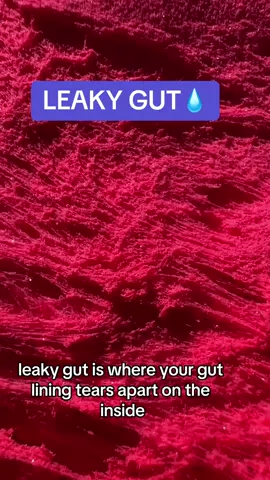 If you have gut and bowel issues it might be caused by leaky gut. Try out these remedies and prepare to be blown away! #guttok #naturalremedy #guthealth #fiber #probiotics #leakygut 