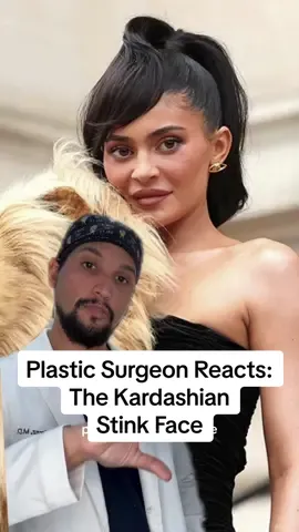 What is the cause for the Kardashian stink face? 🤔 @Dr. Justin Perez breaks down what he thinks might be the main culprits, including Botox, lip flips, lip filler, and even nose surgery. Whether you’re looking to enhance your features or improve a specific part of your look, finding a board-certified plastic surgeon who truly comprehends your vision is key. ✨ DM or call us at 📞 888-276-1535 to get scheduled for a consultation today, virtual options are also available! Disclaimer: Please note that the information in this post is not a substitute for professional medical consultation or treatment. Individuals mentioned in this post are not affiliated with Athenix. #athenix #plasticsurgeonreacts #kyliejenner #kimkardashian #rhinoplasty #facialbalancing #lipfiller #lipflip @chloe
