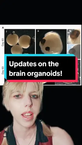 #manmadehorror #brainorganoid #organoids #truehorror #braingames #greenscreen 