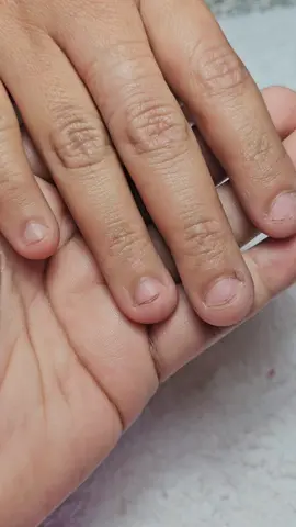 ✨️🙌🏻 SE LOGROOOO... UN MEGA CAMBIO EN LAS MICRO UÑAS DE MI CLIENTA  #tumanicuristafavorita #nails #antesvsdespues #protegeseñorcontuespiritu #cover #blush #exoticnails #nailart #glitter #diosas #ugccommunity #ugccontentcreator #ugccreator #solopaolopuede 