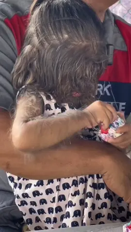 hypertrichosis, an extremely rare congenital disorder that causes excessive hair growth on her face.  #hypertrichosis #1inamillion  #rarecondition #trending #viral #viralvideo #viraltiktok 
