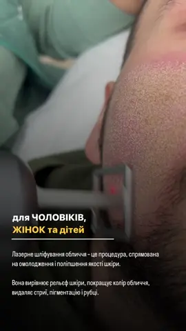 #шліфуванняобличчя #обличчя #клінікакиїв #лазернаяшлифовка 