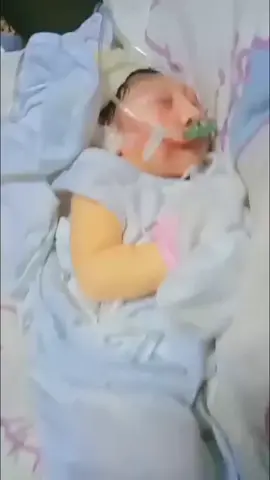 my anencephaly baby 🫶🏻🥺🤍