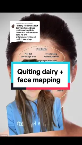 Replying to @mlk #greenscreen a little more on facemapping and cutting milk out of my diet to see if it helps my forehead acne  #flaxseed #diyskincare #facemapping #acneskin #dairyfree 