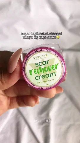 THANK YOU FOR THIS PRODUCT🥺 highly recommended talga bii🫶 #scarremover #scarremovercream #scar #remover #viral #verdefyph  #verdefy #kasoyoil #kasoycream #kasoygirlcara #hydrocare #fyp 