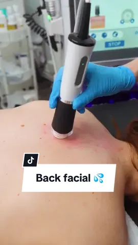 Have you ever tried a back facial? #backfacialtreatment #backtreatment #backfacialmassage #backfacialvideo #asmrfacial 
