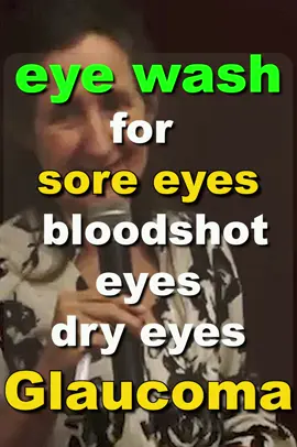 GLAUCOMA - Say Goodbye to Irritation and Redness with This Amazing Eye Wash! #Glaucoma  #EyeHealth #Ophthalmology #Optometry #EyeDoctor #Retina #Oftalmo #EyeSurgery #EyeExam #GlaucomaAwareness #glaucomaawareness #fight#GlaucomaFighter #GlaucomaWarrior  #end #glaucomatreatments #GlaucomaResearch #glaucomababy #glaucomacongênito #Glaucoma  #VisionHealth #SoreEyes #EyeStrain #EyeFatigue #DryEyes #EyeIrritation #EyeHealth  #EyeCare #EyeExam #EyeDoctor #eyereliefe #eyecomfortmode😜 #EyeWellness  #EyeWellbeing #NaturalRemedies  #naturalremedies #HolisticHealth #AlternativeMedicine  #HerbalRemedies #PlantMedicine #Homeopathy #Aromatherapy #Ayurveda #Naturopathy  #TraditionalMedicine #WholeFoods #Herbalism #Vitamins #Supplements #Mindfulness  #SelfCare #WellnessJourney #NaturalHealing #HolisticLivin #AlternativeHealing  #tea #tee #drinktea #eyebright #strain #goldenseal #goldensealroot #fyp #fy #fypシ #fypシ゚viral #fypage #fyppppppppppppppppppppppp #fypp #fyy #fypdong #barbara #barbaraoneill #naturalremedy #homeremedy #tretment #doit #doityourself #Recipe #recipes #naturalrecipe #heal #health #healthy #healing #keepheathy #didyouknew #perfect #barbaraoniell #tok #tokyo #india #indian #keep #water #boil #cup #little #day #eyes #eye #glaucomaweek2023  #sightloss  #blind  #blundtok #uveitis #chronicillness #secondaryglaucoma  #glaucomaspike #congenitalglaucomapt2 #mycongenitalglaucomababy #fypシ゚ #myexperience #firstimemom #awareness #spreadawareness #signsofCongenitalglaucoma #babiesoftiktok #glaucoma  #cataracts  #aniridia  #fypgakni  #preemiestrong  #nicugraduate  #ASD  #eyeawareness  #tubiebaby  #naturalremedy  #womenshealth  #heathyrecipes #Stye  #EyeHealth  #BacterialInfection  t #opticalillusion