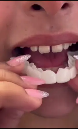 #snap_on_smile #فينير_متحرك #lab #fyp #fypage #veneers_smile 