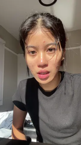 #take care of pimple #burmesegirls🇲🇲 