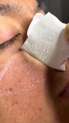 ✨Trying the @Lanbena pore kit ✨ yall wanted me to wax my husbands brows so i did wait till the end 😆 & thanks for making me go viral 🫶🏼 #fyl#lanbenaporestrips#pores#porestrips#teavelkit#satisfyingvideo