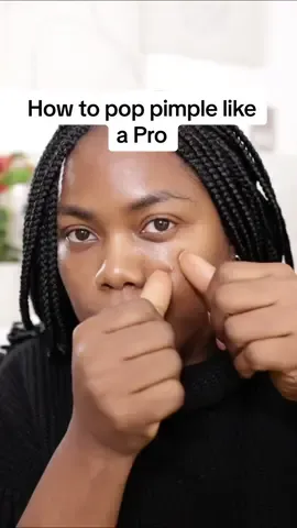 If you have ever done this or you are still doing any of this, I need you to gather around! That slap on my wrist has to go round 😂😂😂 WHAT TO DO WHEN YOU HET A PIMPLE: 1) Use a pimple patch  2) Use a spot treatment containing sulphur, benzoyl peroxide or salicylic acid etc 3) Leave it alone  Did you notice I didn’t add lemon, Colgate, robb, aboniki, mentholated spirit or palm oil? It’s because it’s unnecessary and potentially harmful.  #pimplepopper #pimple #skincare #acnetreatments #clearskin #clearskinjourney #clearskinroutine #skincareuk 
