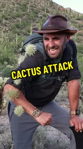 How to remove cactus spines…. 2016 - when I fell into a cholla cactus catching the tarantula hawk #howto #ouchie #cactus #learnfromme 
