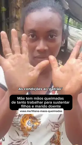 Difícil não se emocionar.💔 Com as mãos queimadas de tanto trabalhar, Liliane pede socorro. O marido está ficando cego e a família vive numa casa de taipa caindo aos pedaços na região rural de Abaetetuba, no Pará. As crianças choram de fome e vivem numa realidade desumana. Doe pelo link na bio