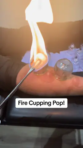 Addressing a calf injury that was sustained through playing sports. Fire Cupping and a bit of graston reduced the inflammation and pain . . . #cuppingtherapy #hertscupping  #hijama #hijamatherapy #hijamah #cuppingmassagetherapy #hijamacuppingtherapy #hijamatherapist #hijamahtherapy #hijamacupping #hijamaclinic #hijamasunna #wetcuppingtherapy #drycuppingtherapy #hijamahpractitioner #cupping #massagetherapist #painrelief #علاج #backpain #wholistichealth #cuppingmassage  #cuppingtherapist #wetcupping #حجامة #drycupping #الحجامة_الوقائية #firecupping #calfinjury #calves 