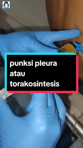 punksi pleura atau torakosintesis sedot cairan di paru#effusipleura#effusipleuramasif#pleuraleffusion#spesialisparu#spesialisparumedan#dokterparu#dokterviral#foryoupage#foryou#fypシ゚viral#fypシ#fyp 