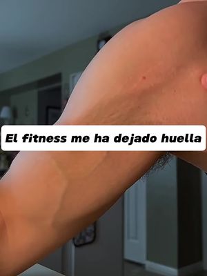 ¡Siga con VGO y sus cicatrices y líneas finas se desvanecerán hasta desaparecer!