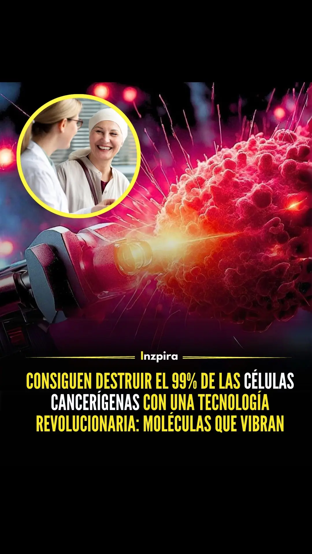 Investigadores de Rice, Texas A&M y la Universidad de Texas hallaron un novedoso método para eliminar las células cancerosas. 🔬😮 Utilizaron luz infrarroja cercana para desencadenar vibraciones sincronizadas en moléculas de aminocianina, rompiendo eficazmente las membranas celulares. Según el estudio, Nature Chemistry informa de una eficacia del 99% en la destrucción de células de melanoma humano mediante un nuevo método. Los investigadores, dirigidos por el químico de Rice James Tour, descubrieron un método más rápido, similar a los martillos neumáticos moleculares, que utiliza compuestos a nanoescala activados por la luz. Esta innovación es un millón de veces más rápida que los intentos anteriores que utilizaban motores Feringa. - #noticias #viral #salud #médico #medicina #pubertad #cancer 