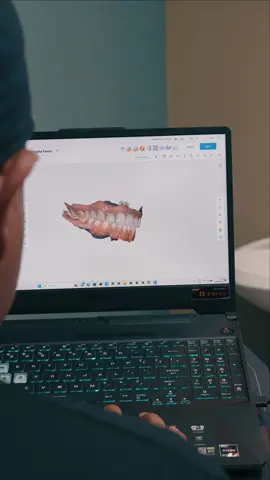 Video para una clinica dental: @Excel Dental 🦷  #guatemala #dentista #videography #filmmaker #zve10 #sony #odontologo #odontologoguatemala 