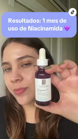 👇🏻Mis resultados usando el serum de Niacinamida Pura de @La Roche-Posay  La verdad es que es un producto increible, no solo trabaja en la mancha, si no que renueva la piel unificando el tono y también actúa en la barrera de la como prevención. Tienene acción 👇🏻👇🏻👇🏻 👉🏻Anti pigmento para: Bloquear la transferencia de melanina 👉🏻Anti inflamactorio para Inhibir mediadores inflamatorios 👉🏻Protección para Fortalecer la barrera cutánea #niacinamidefm #larocheposay #serumboost  #larocheposayskincare  #serumniacinamida  #serummanchas #manchasfaciales @For_me tips México 🇲🇽 #manchas  #publicidad #niacinamida #skincare #serum 