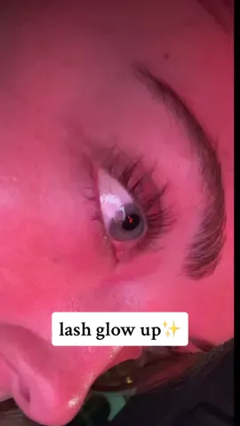 the before picture is CRAZY😭😭 b4 yall ask i use the Babe Original lash serum!! i linked it in my bio! #greenscreen 